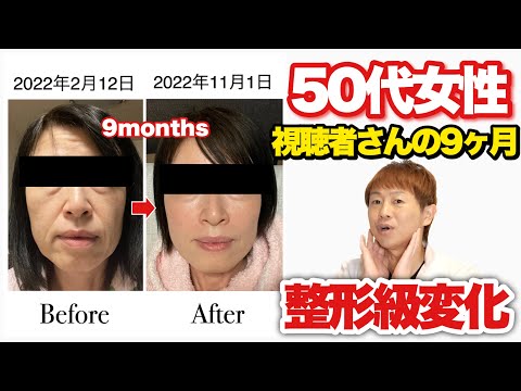 Thumbnail for 【ほうれい線・ブルドッグ顔】視聴者さんが9ヶ月で変化した方法！