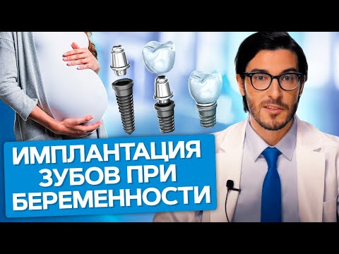 Thumbnail for Имплантация зубов при беременности. Возможна ли имплантация зубов в период беременности и лактации?