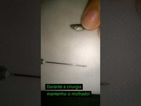 Cirurgia em peixe com HIDROPSIA OU BARRIGA D&apos;ÁGUA!