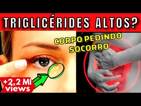 Thumbnail for 7 DICAS PARA BAIXAR OS TRIGLICERÍDEOS ALTOS | Faça isso para se livrar da GORDURA NO SANGUE
