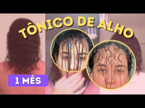 Thumbnail for 1 mês usando tônico de alho - resultados + dúvidas frequentes  | Transição Capilar