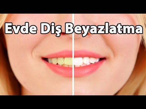 Evde Diş Beyazlatma İşlemi - Diş Sararmasına Ne iyi Gelir ?