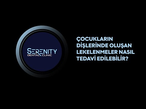 Çocukların Dişlerinde Oluşan Lekelenmeler Nasıl Tedavi Edilebilir?