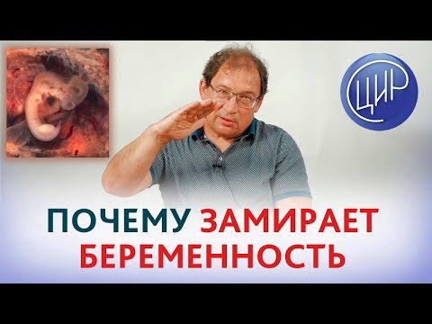 Thumbnail for Причины замершей беременности. Почему происходит остановка развития беременности. Гузов И.И.