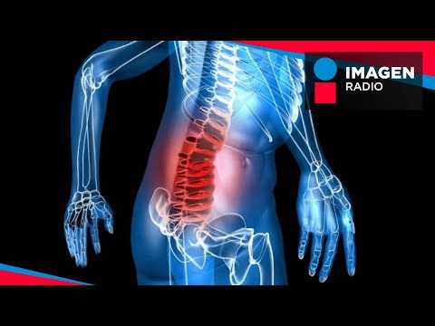 ¿Qué es y qué causa el mieloma múltiple?