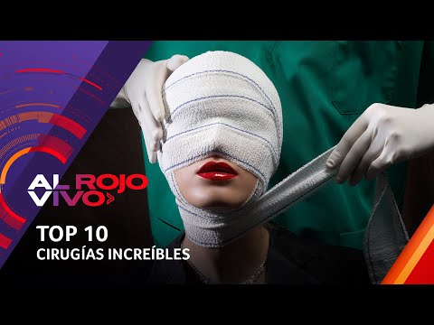 Thumbnail for TOP 10: Las cirugías y operaciones más impactantes