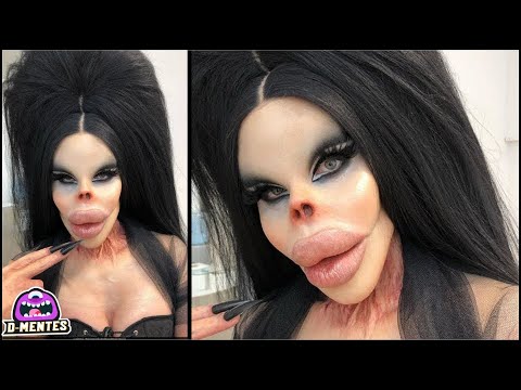 Thumbnail for 7 Personas que Llevaron sus Cirugías Plásticas DEMASIADO Lejos