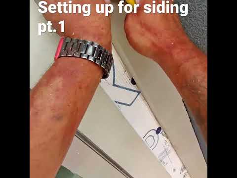 Thumbnail for Set up 1