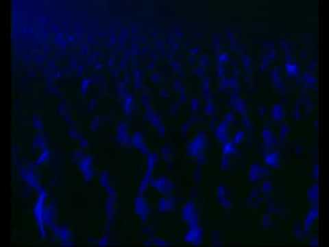 Thumbnail for Laurent Garnier Crispy Bacon Live