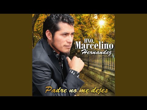 Thumbnail for Ep Toox Jmul