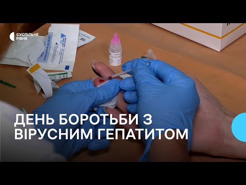 &quot;Гепатиту не чекай&quot;: у чому небезпека хвороби та як їй запобігти