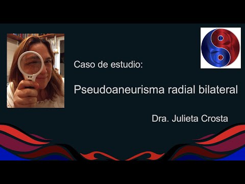 Caso de estudio Pseudoaneurismas radiales
